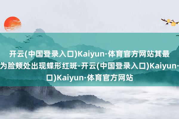 开云(中国登录入口)Kaiyun·体育官方网站其最具特征的阐发为脸颊处出现蝶形红斑-开云(中国登录入口)Kaiyun·体育官方网站